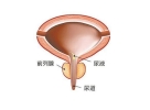 前列腺炎的危害有哪些？