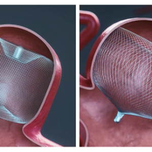 上海今年首款Ⅲ类创新医疗器械获批上市！浦东持续打造全球创新药械首发地