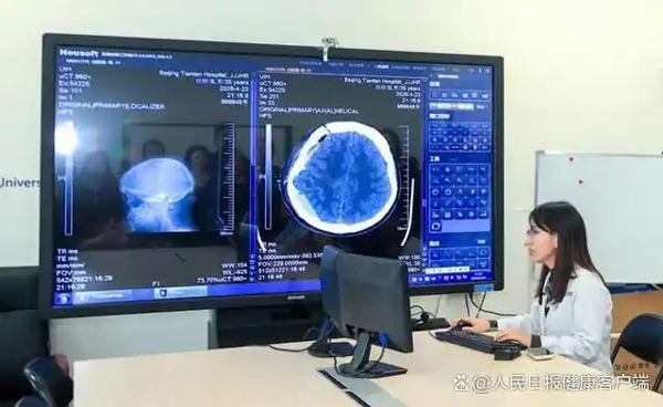 1分钟能看94种疾病，天坛医院颅脑CT诊断有了“数字超人”