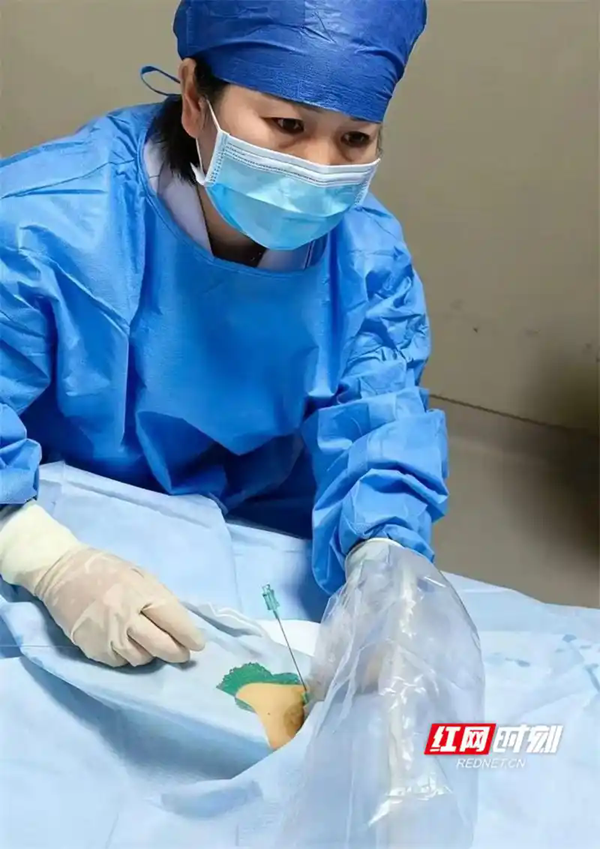 永州市第四人民医院完成首例股静脉PICC置管术