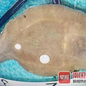 广西一女子肝脏被吃掉三分之一，“元凶”取出来后仍游动……
