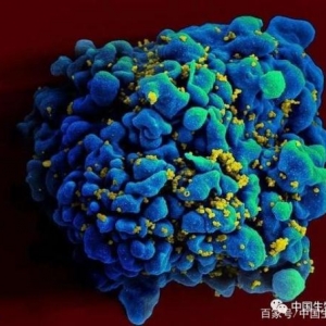 最新研究：艾滋病毒在“男女性行为”传播时会导致更强的毒性