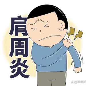 肩周炎能自愈吗