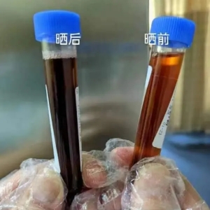 95后女生腹痛难忍口吐“黑水” 被称作吸血鬼病