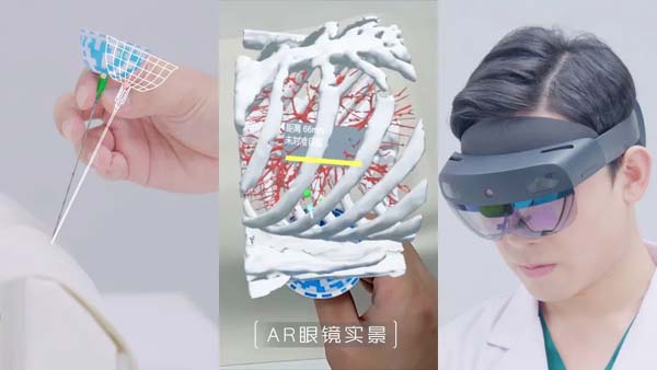 AR导航手术系统与国产诊断设备齐发力，浦东创新药械产品持续上新