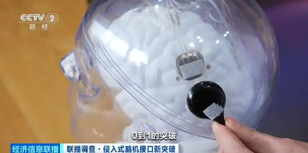 全球首款侵入式脑机接口医疗器械上市 能治什么？效果如何？